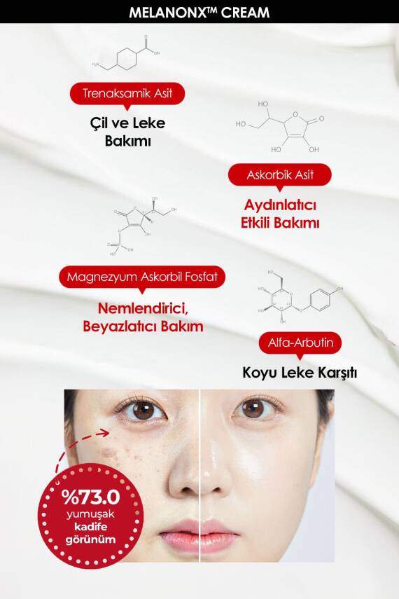 Leke ve Çil Kremi Medipeel Melanon X Cream 30ml - 3